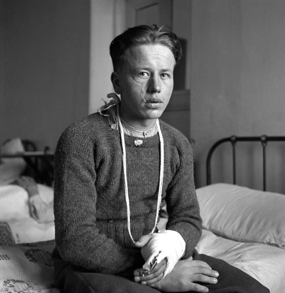 Viljo Suokas kuvattuna haavoittumisensa jälkeen joulukuussa 1941 sotasairaalassa. Hän ei koskaan kertonut OsKussa, missä tilanteessa hänen kasvojensa arvet olivat syntyneet. 