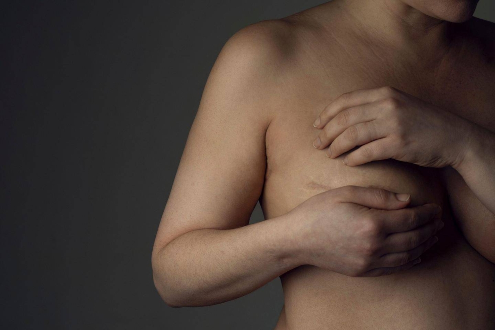 Suomessa rintasyöpään sairastuu noin 5 000 naista vuodessa.