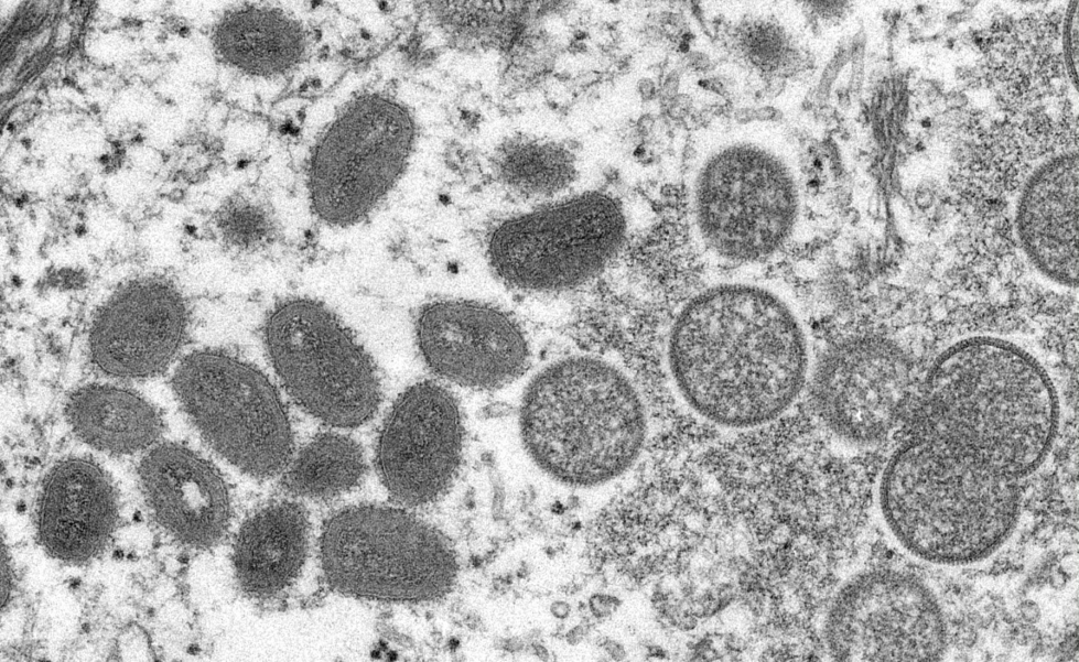Apinarokkovirus elektronimikroskooppikuvassa. LEHTIKUVA / AFP