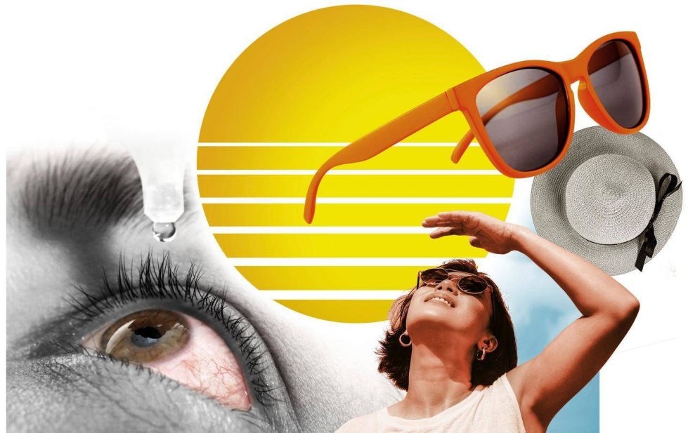 Aurinkoisella säällä hattu ja aurinkolasit suojaavat silmiä. Silmätipoista voi olla apua auringonvalon kuivattamille silmille.