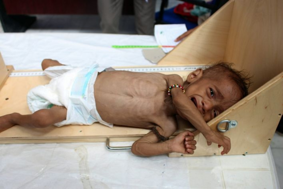 YK:n mukaan nälänhätä uhkaa Jemenissä nyt 14:ää miljoonaa ihmistä. LEHTIKUVA/AFP