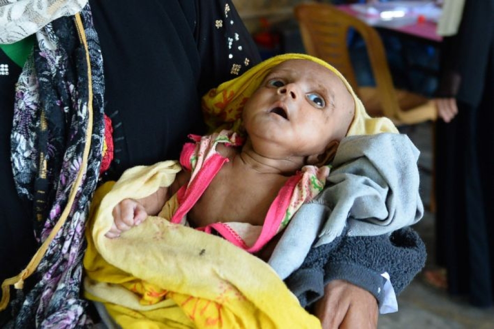 Viime vuonna kuoli yli kuusi miljoonaa lasta. LEHTIKUVA/AFP