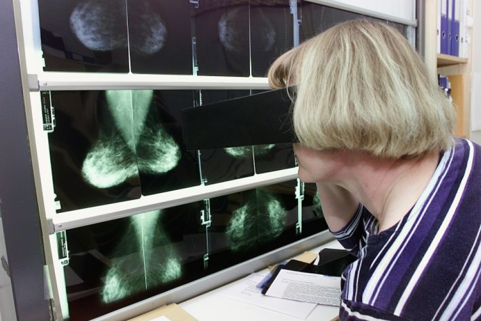 Mammografian röntgenkuvia tutkittavana syöpäjärjestöjen poliklkinikalla.