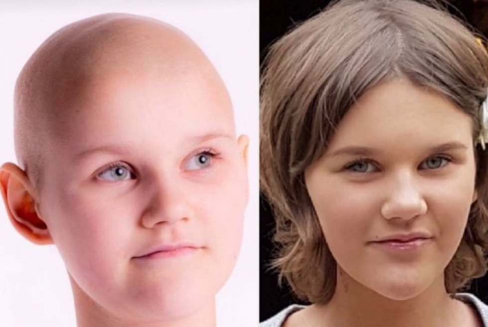 Liperiläinen Milla Silvennoinen, 14, sairastaa parantumatonta syöpää.