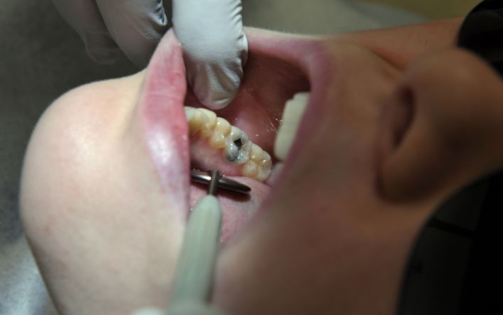 Amalgaamia on käytetty hampaiden paikkaamisessa liki 200 vuotta, sillä se on varsin edullista ja kestää hyvin purentaa.  Kuva: Lehtikuva / Kimmo Mäntylä