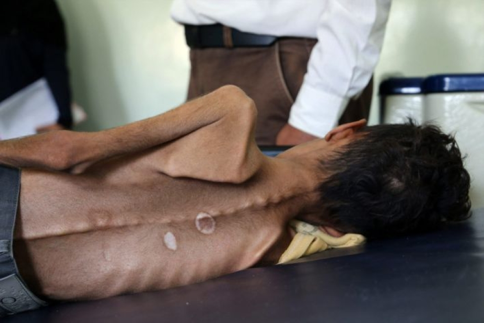 Järjestöt sanovat, että Jemenin humanitaarinen kriisi on ihmisten aiheuttama ja suora seuraus sodan osapuolten ankarista ruoan, polttoaineen, lääkkeiden ja humanitaarisen avun rajoituksista. LEHTIKUVA / AFP