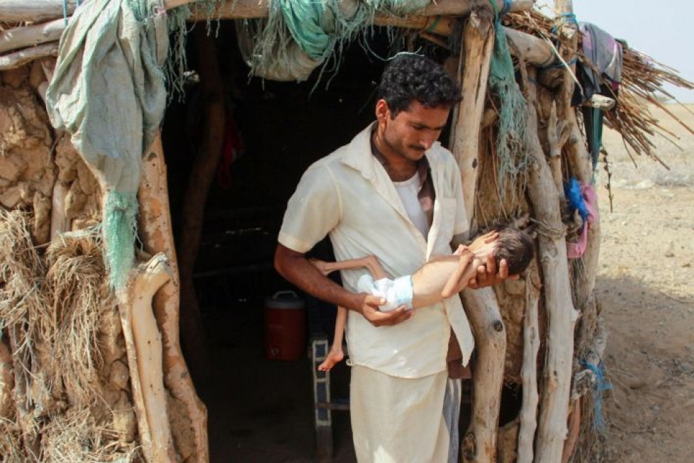 Isä pitelee vakavasta aliravitsemuksesta kärsivää tytärtään Hajjahin maakunnassa Jemenissä tällä viikolla otetussa kuvassa. LEHTIKUVA / AFP